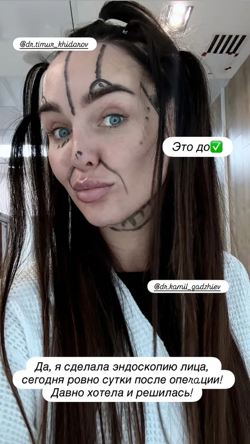 Светлана Сильваши перед операцией