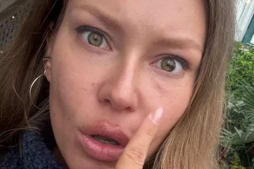 «У меня дыра в щеке»: Рита Дакота призналась, почему ей придется сделать повторную пластику «У меня дыра в щеке»: Рита Дакота призналась, почему ей придется сделать повторную пластику