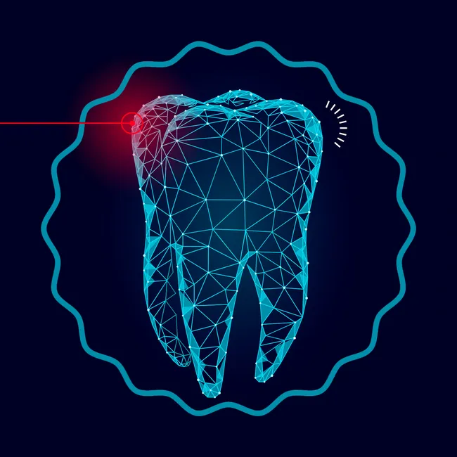 Лазер против бормашины: 3 главных отличия трендовой лазерной стоматологии от традиционной