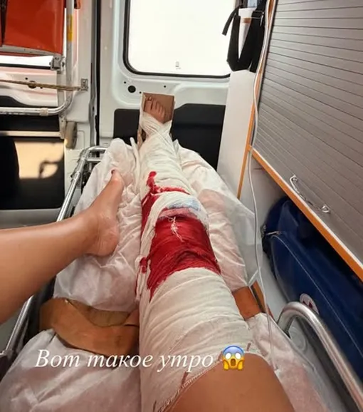 Ольга Бузова серьезно пострадала Ольга Бузова серьезно пострадала