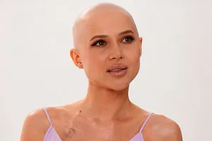 «Сервисы не справляются»: у онкобольной Лерчек возникли проблемы с новым брендом косметики