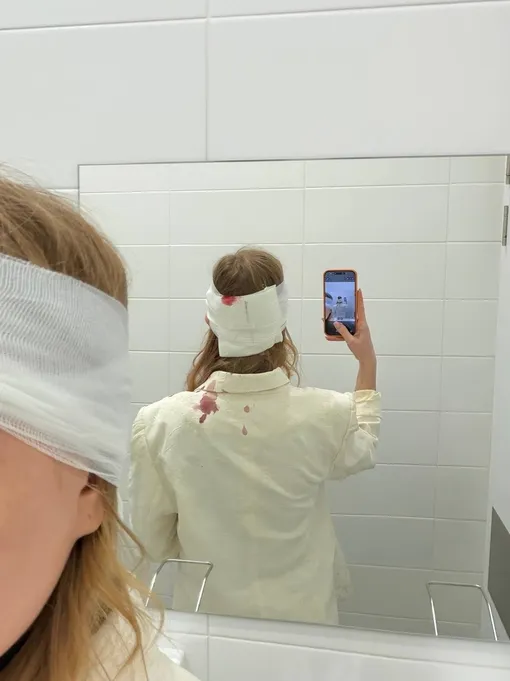 Девушка получила травму головы в элитном московском ресторане