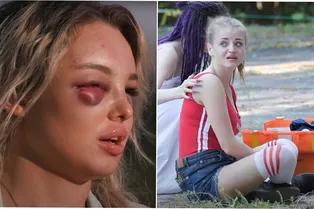 Перелом ключицы: участницу шоу «Пацанки» после драки увезли в больницу