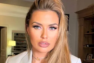 «Я в 26 лет уже колола себе гель!»: как Виктория Боня получила асимметрию лица