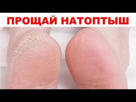 Нажми и смотри