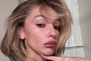 «Муж не может разглядеть мое уродство»: Настя Ивлеева показала лицо крупным планом «Муж не может разглядеть мое уродство»: Настя Ивлеева показала лицо крупным планом