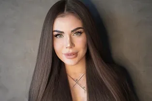 «Я испортила нос и взгляд за 16 тысяч евро»: София Стужук сделала три пластики, чтобы исправить неудачные операции