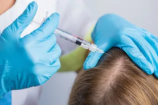 Мезотерапия для волос: процедура, лучшие препараты и отзывы пациентов