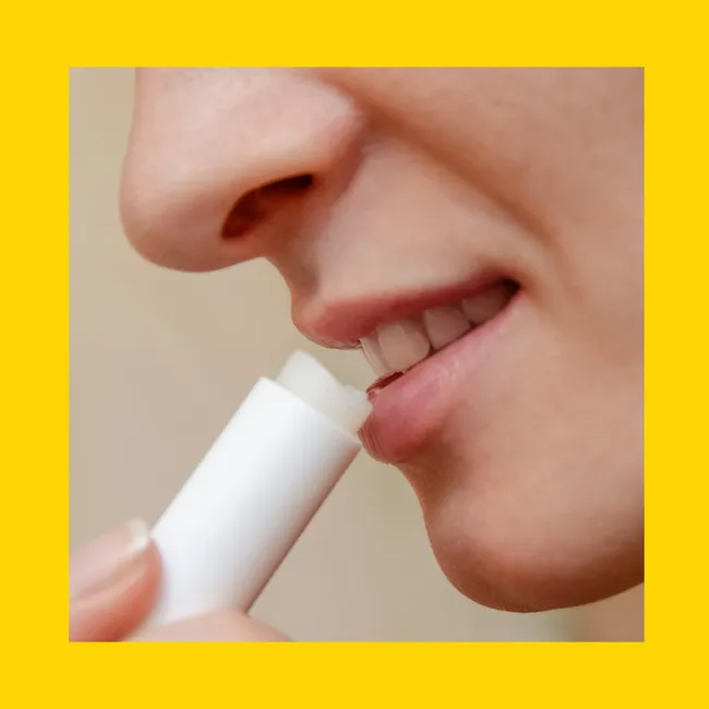 Что делать, если сильно обветрились губы, а завтра — важное свидание?