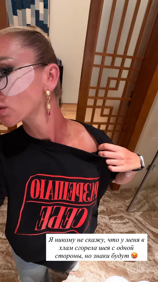 Ольга Бузова показала ожог на коже Ольга Бузова показала ожог на коже