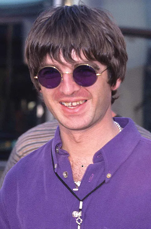 виниры у звезд фото до и после