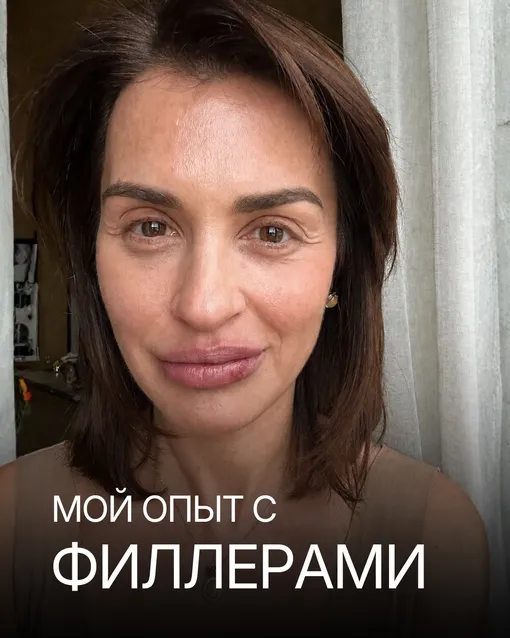 Ирина Муромцева заявила, что филлеры опасны Ирина Муромцева заявила, что филлеры опасны