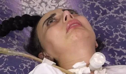 Нигяр Будагова оказалась парализована после ринопластики Нигяр Будагова оказалась парализована после ринопластики