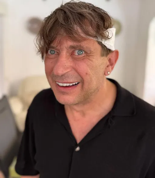 Лева Би-2 перенес операцию