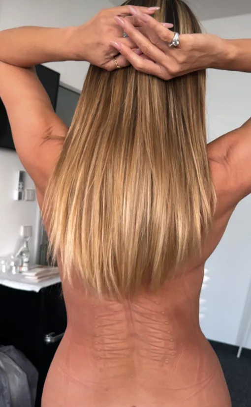 Хайди Клум показала следы от корсета на коже