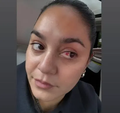 У Ванессы Хадженс лопнул сосуд во время схваток