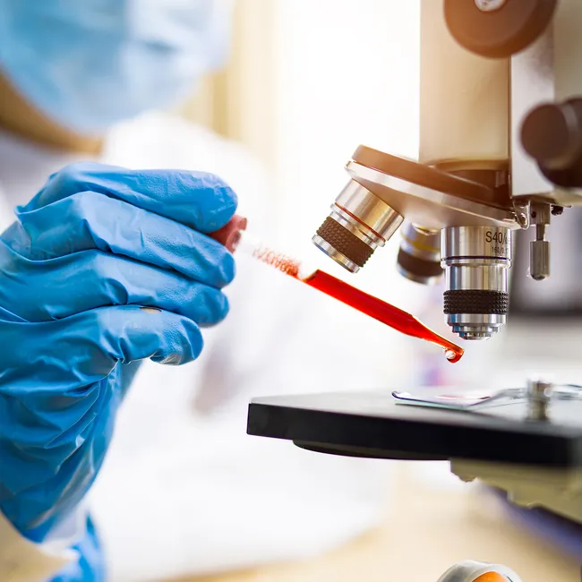 Это ловушка: анализы на онкомаркеры часто бесполезны и даже опасны