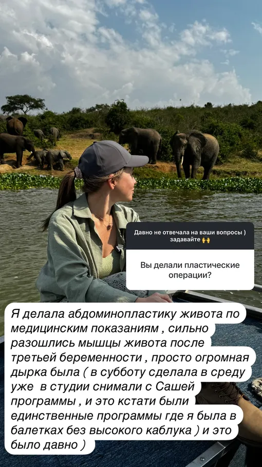 Юлия открыто рассказала о пластической операции