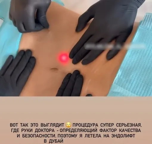 Елена Перминова сделала безоперационную подтяжку кожи Елена Перминова сделала безоперационную подтяжку кожи