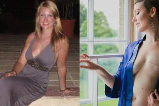 Можно быть красивой без груди: девушка после операции показала откровенные фото Можно быть красивой без груди: девушка после операции показала откровенные фото