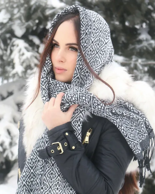 Анастасии Швецовой сделали пластику в Сеуле