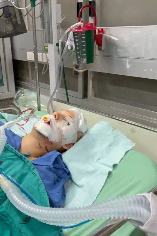 Екатерина Блинова впала в кому после аварии на байке в Таиланде